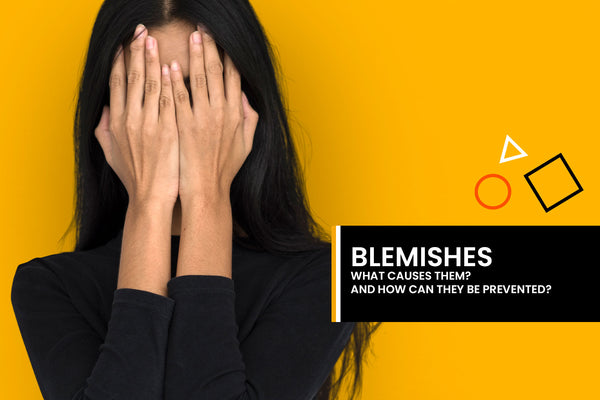 What causes blemishes and how can we stop them?