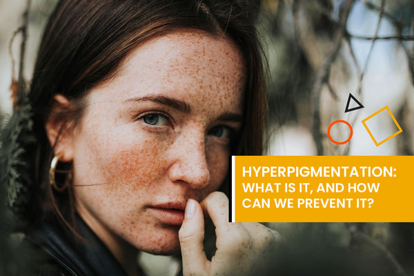 Hyperpigmentation: what is it, and how can we prevent it?