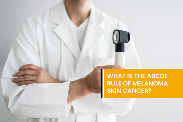 What is the ABCDE rule of melanoma skin cancer?