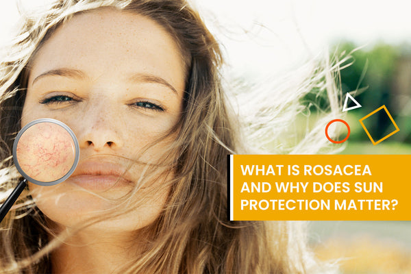 What is rosacea and why does sun protection matter?